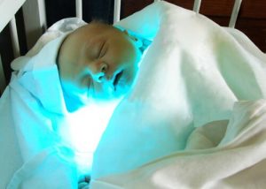 新生児黄疸の意味と治療法は?