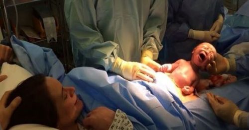 帝王切開が女性の身体に及ぼす進化的影響