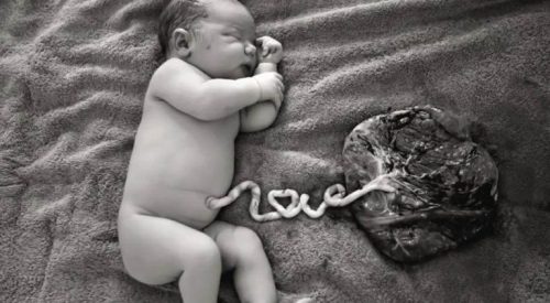 へその緒の血液を提供