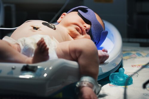 新生児の黄疸について