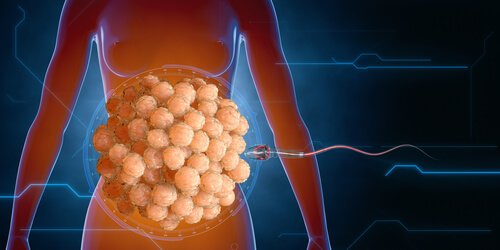 精子 と免疫システム