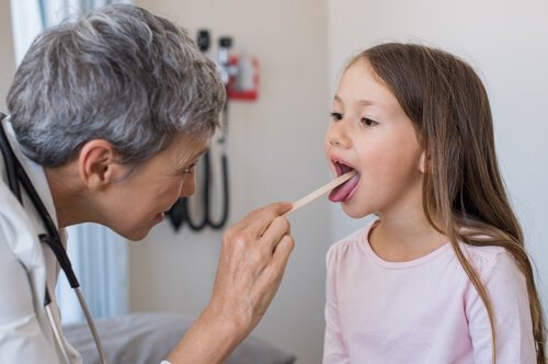 子どもの地図状舌の症状