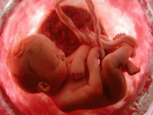 様々な胎児の体位　胎児の体位　出産方法