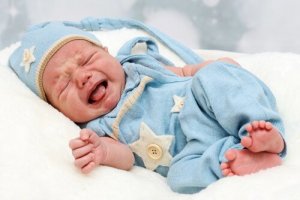 幼児の水腎症:症状と見分け方、そして治療法
