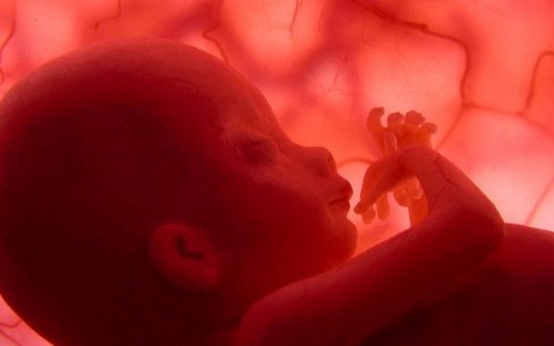 胎児 奇胎妊娠　胞状奇胎