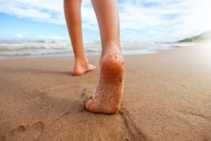 子供のO脚を治すには?