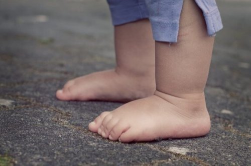 子どもの軟骨無形成症について:その原因と特徴を見てみよう