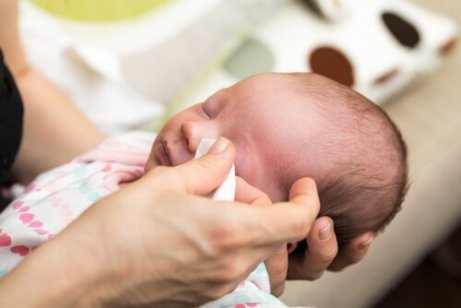 赤ちゃんに起こる結膜炎の原因 その症状 治療 予防法