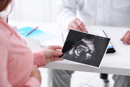 超音波検査　妊娠中   赤ちゃん   体重 デクセウスの法則